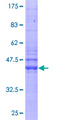 IFITM2 Protein - 12.5% SDS-PAGE of human IFITM2 stained with Coomassie Blue