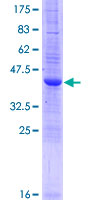 IFITM2 Protein - 12.5% SDS-PAGE of human IFITM2 stained with Coomassie Blue