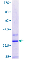 IFITM2 Protein - 12.5% SDS-PAGE Stained with Coomassie Blue.