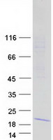 IFITM5 Protein - Purified recombinant protein IFITM5 was analyzed by SDS-PAGE gel and Coomassie Blue Staining