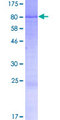 IFIX / PYHIN1 Protein - 12.5% SDS-PAGE of human PYHIN1 stained with Coomassie Blue