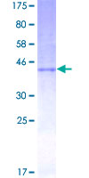 IFN Beta / Interferon Beta Protein - 12.5% SDS-PAGE of human IFNB1 stained with Coomassie Blue