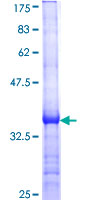IFN Beta / Interferon Beta Protein - 12.5% SDS-PAGE Stained with Coomassie Blue.