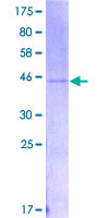 IFN Gamma / Interferon Gamma Protein - 12.5% SDS-PAGE of human IFNG stained with Coomassie Blue