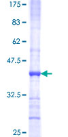IFN Gamma / Interferon Gamma Protein - 12.5% SDS-PAGE Stained with Coomassie Blue.