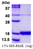 IFN Gamma / Interferon Gamma Protein