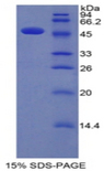 IFNA / Interferon Alpha Protein - Recombinant Interferon Alpha By SDS-PAGE
