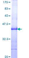 IFNA1 / Interferon Alpha 1 Protein - 12.5% SDS-PAGE Stained with Coomassie Blue.