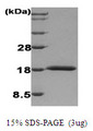 IFNA1 / Interferon Alpha 1 Protein