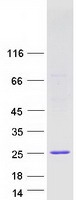 IFNA10 / Interferon Alpha 10 Protein - Purified recombinant protein IFNA10 was analyzed by SDS-PAGE gel and Coomassie Blue Staining
