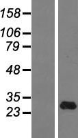 IFNA14 / Interferon Alpha 14 Protein - Western validation with an anti-DDK antibody * L: Control HEK293 lysate R: Over-expression lysate