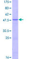 IFNA14 / Interferon Alpha 14 Protein - 12.5% SDS-PAGE of human IFNA14 stained with Coomassie Blue