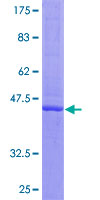 IFNA16 / Interferon Alpha 16 Protein - 12.5% SDS-PAGE of human IFNA16 stained with Coomassie Blue