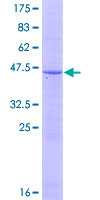 IFNA17 / Interferon Alpha 17 Protein - 12.5% SDS-PAGE of human IFNA17 stained with Coomassie Blue