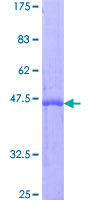 IFNA2 / Interferon Alpha 2 Protein - 12.5% SDS-PAGE of human IFNA2 stained with Coomassie Blue