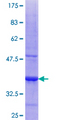 IFNA2 / Interferon Alpha 2 Protein - 12.5% SDS-PAGE Stained with Coomassie Blue.