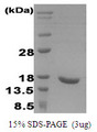 IFNA2 / Interferon Alpha 2 Protein