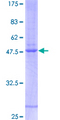 IFNA21 / Interferon Alpha 21 Protein - 12.5% SDS-PAGE of human IFNA21 stained with Coomassie Blue