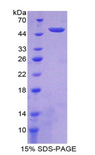 IFNA21 / Interferon Alpha 21 Protein - Recombinant Interferon Alpha 21 By SDS-PAGE
