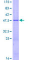 IFNA4 / Interferon Alpha 4 Protein - 12.5% SDS-PAGE of human IFNA4 stained with Coomassie Blue