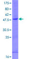 IFNA5 / Interferon Alpha 5 Protein - 12.5% SDS-PAGE of human IFNA5 stained with Coomassie Blue