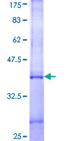 IFNA5 / Interferon Alpha 5 Protein - 12.5% SDS-PAGE Stained with Coomassie Blue.