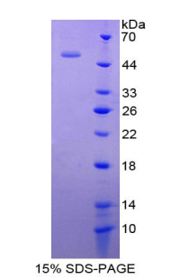 IFNA5 / Interferon Alpha 5 Protein - Recombinant Interferon Alpha 5 By SDS-PAGE