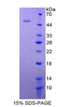 IFNA5 / Interferon Alpha 5 Protein - Recombinant Interferon Alpha 5 By SDS-PAGE