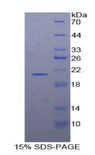 IFNA7 / Interferon Alpha 7 Protein - Recombinant Interferon Alpha 7 By SDS-PAGE