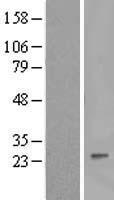IFNA8 / Interferon Alpha 8 Protein - Western validation with an anti-DDK antibody * L: Control HEK293 lysate R: Over-expression lysate