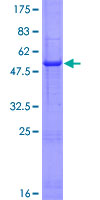 IFNA8 / Interferon Alpha 8 Protein - 12.5% SDS-PAGE of human IFNA8 stained with Coomassie Blue