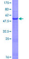 IFNA8 / Interferon Alpha 8 Protein - 12.5% SDS-PAGE of human IFNA8 stained with Coomassie Blue