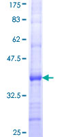 IFNA8 / Interferon Alpha 8 Protein - 12.5% SDS-PAGE Stained with Coomassie Blue.