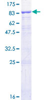IFNAR1 / IFNAR Protein - 12.5% SDS-PAGE of human IFNAR1 stained with Coomassie Blue