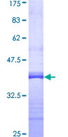 IFNAR1 / IFNAR Protein - 12.5% SDS-PAGE Stained with Coomassie Blue.