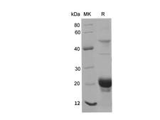 IFNAR1 / IFNAR Protein - Recombinant Human IFNAR1 Protein (His Tag)-Elabscience