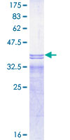 IFNAR2 Protein - 12.5% SDS-PAGE Stained with Coomassie Blue.