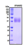 IFNAR2 Protein - SDS-PAGE under reducing conditions and visualized by Coomassie blue staining