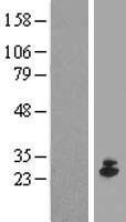 IFNE / Interferon Epsilon Protein - Western validation with an anti-DDK antibody * L: Control HEK293 lysate R: Over-expression lysate