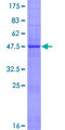 IFNE / Interferon Epsilon Protein - 12.5% SDS-PAGE of human IFNE1 stained with Coomassie Blue