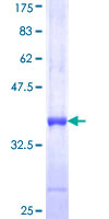IFNE / Interferon Epsilon Protein - 12.5% SDS-PAGE Stained with Coomassie Blue.
