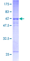 IFNGR2 Protein - 12.5% SDS-PAGE of human IFNGR2 stained with Coomassie Blue