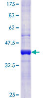 IFNGR2 Protein - 12.5% SDS-PAGE Stained with Coomassie Blue.
