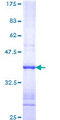 IFNK Protein - 12.5% SDS-PAGE Stained with Coomassie Blue.