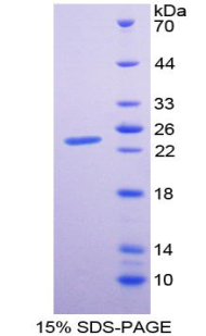 IFNL1 / IL29 Protein - Recombinant  Interleukin 29 By SDS-PAGE