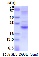 IFNL2 / IL28A Protein