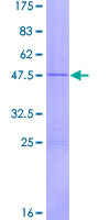 IFNW1 Protein - 12.5% SDS-PAGE of human IFNW1 stained with Coomassie Blue