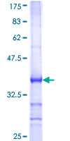 IFNW1 Protein - 12.5% SDS-PAGE Stained with Coomassie Blue.