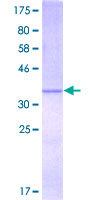 IFT122 / WDR10 Protein - 12.5% SDS-PAGE Stained with Coomassie Blue.
