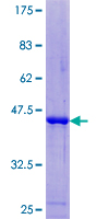 IFT20 Protein - 12.5% SDS-PAGE of human IFT20 stained with Coomassie Blue